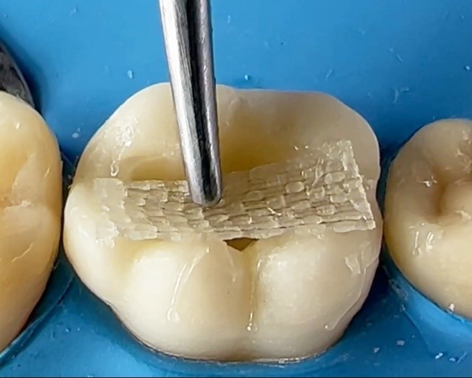 دنت منت - فروشگاه آنلاین کالای دندانپزشکی - Picture2