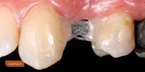 Fiber reinforced composite
