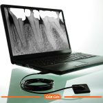 سنسور آر وی جی کداک  Carestream RVG 5200 - تصویر 3