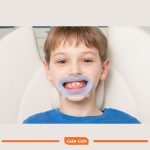 دهان بازکن اوپتراگیت بدون لاتکس OptraGate 3D OptraGate Retractors - تصویر 3